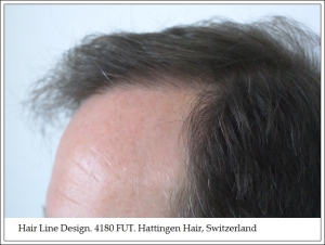 Hair Line Design. 4180 FUT. Hattingen Hair, Switzerland